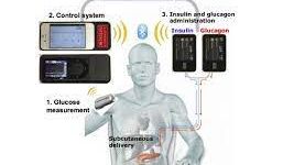 A “Bionic Pancreas” for Type 1 Diabetes?